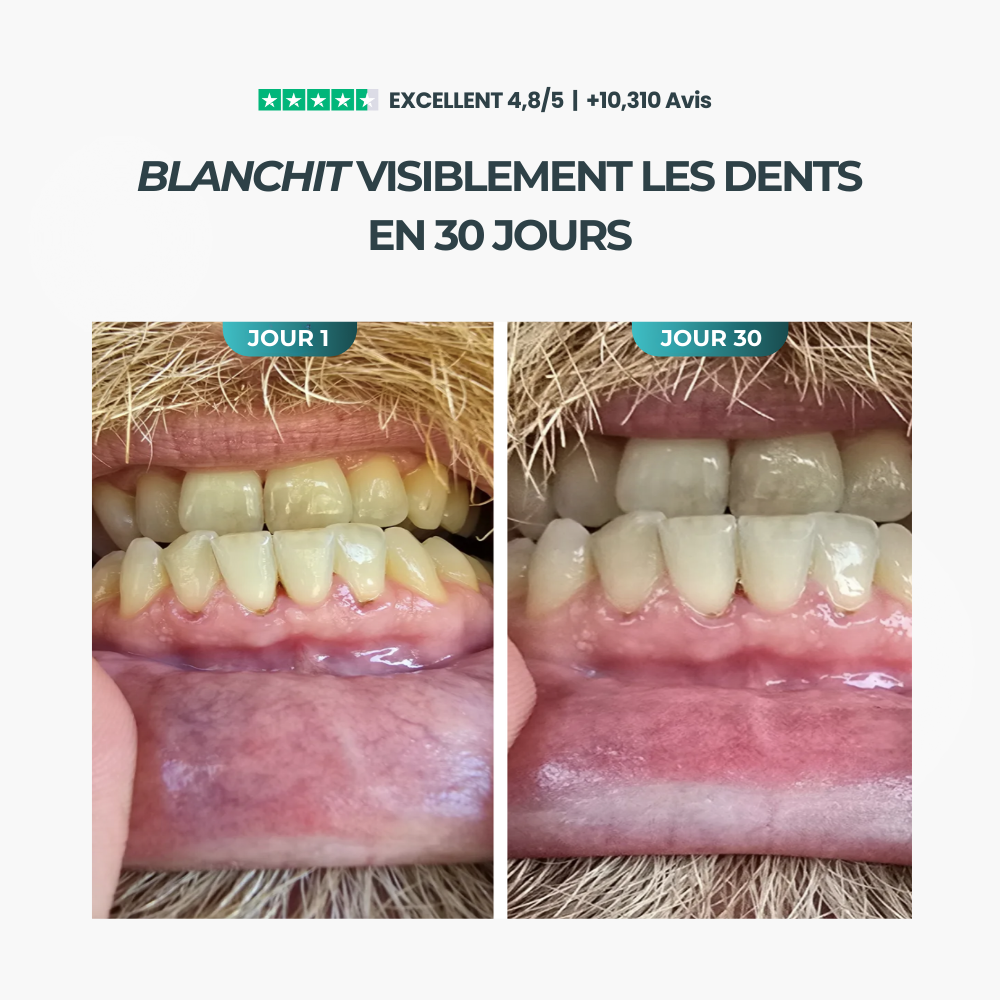 Vita Gum™- Chewing-Gum Reminéralisant
